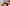 Minoxidil for a Receding Hairline: Results, Timeline, and What to Realistically Expect