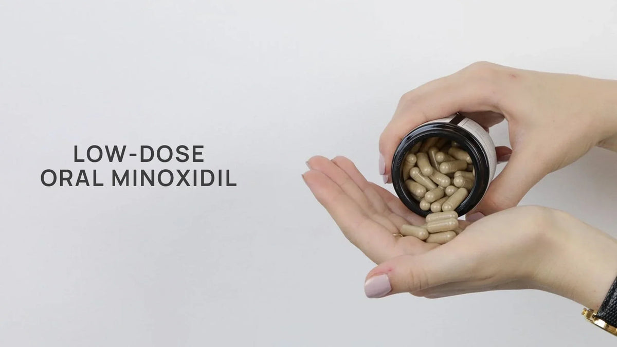 Low-Dose Oral Minoxidil: The Off-Label Treatment Everyone Is Searching in 2026