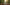 Best Medicated Shampoo for Dandruff and Hair Fall in Pakistan