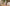 Clascoterone (Breezula): The First New Hair Loss Drug in 30 Years