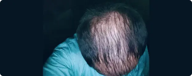 Close-up of a person wearing a teal jacket with a dark background